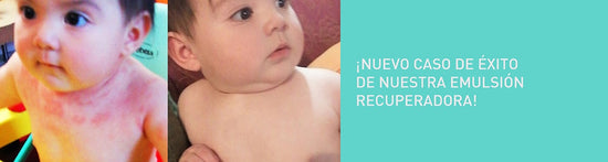 Nuevo Caso de éxito de nuestra Emulsión Recuperadora