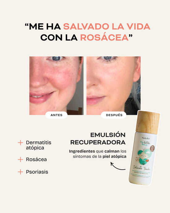 Delicate Touch - Emulsión Recuperadora | Para pieles con dermatitis, rosácea o sensibilidad